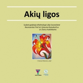 Akių ligos