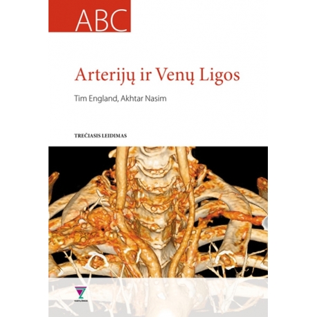 Arterijų ir venų ligos