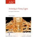 Arterijų ir venų ligos